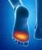 EPITACT EPITHELIUM ACTIV - Protezioni Duroni