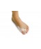 Double loop bunion spreader